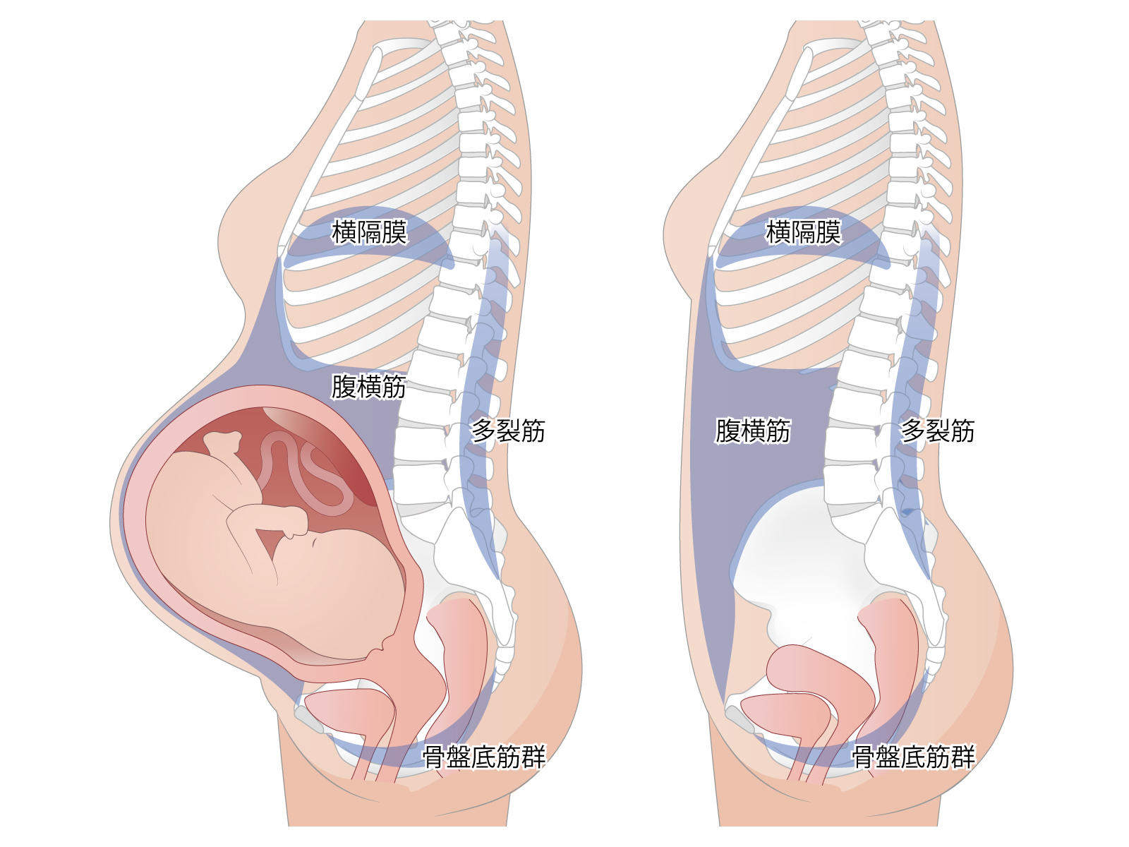 妊娠中の腹部の膨隆