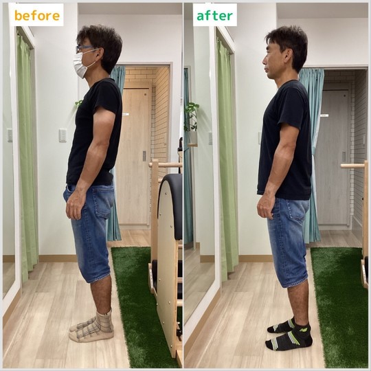 ビフォーアフター③