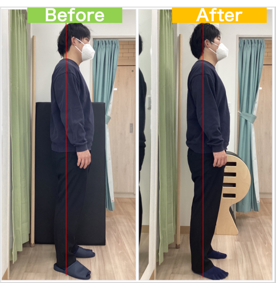 ビフォーアフター①