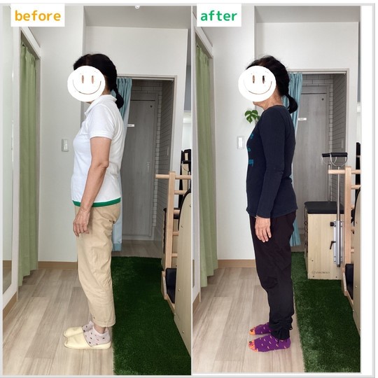 ビフォーアフター⑤